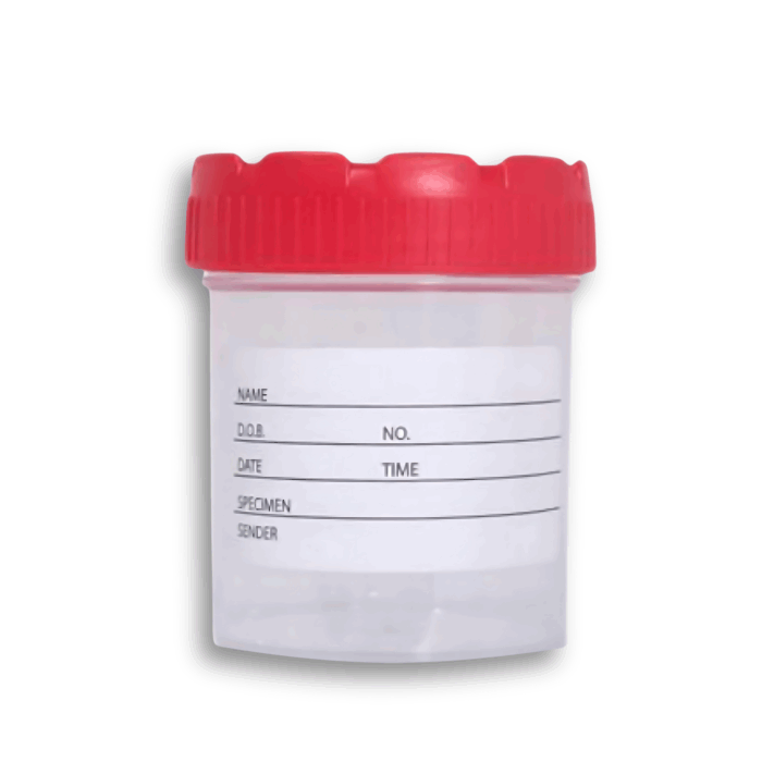 60/70ml sterile Sample container PP/HDPE, Labelled - Image 2